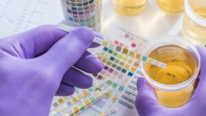 how long do drug test results take urine tests, one of the more common ones, is especially quick